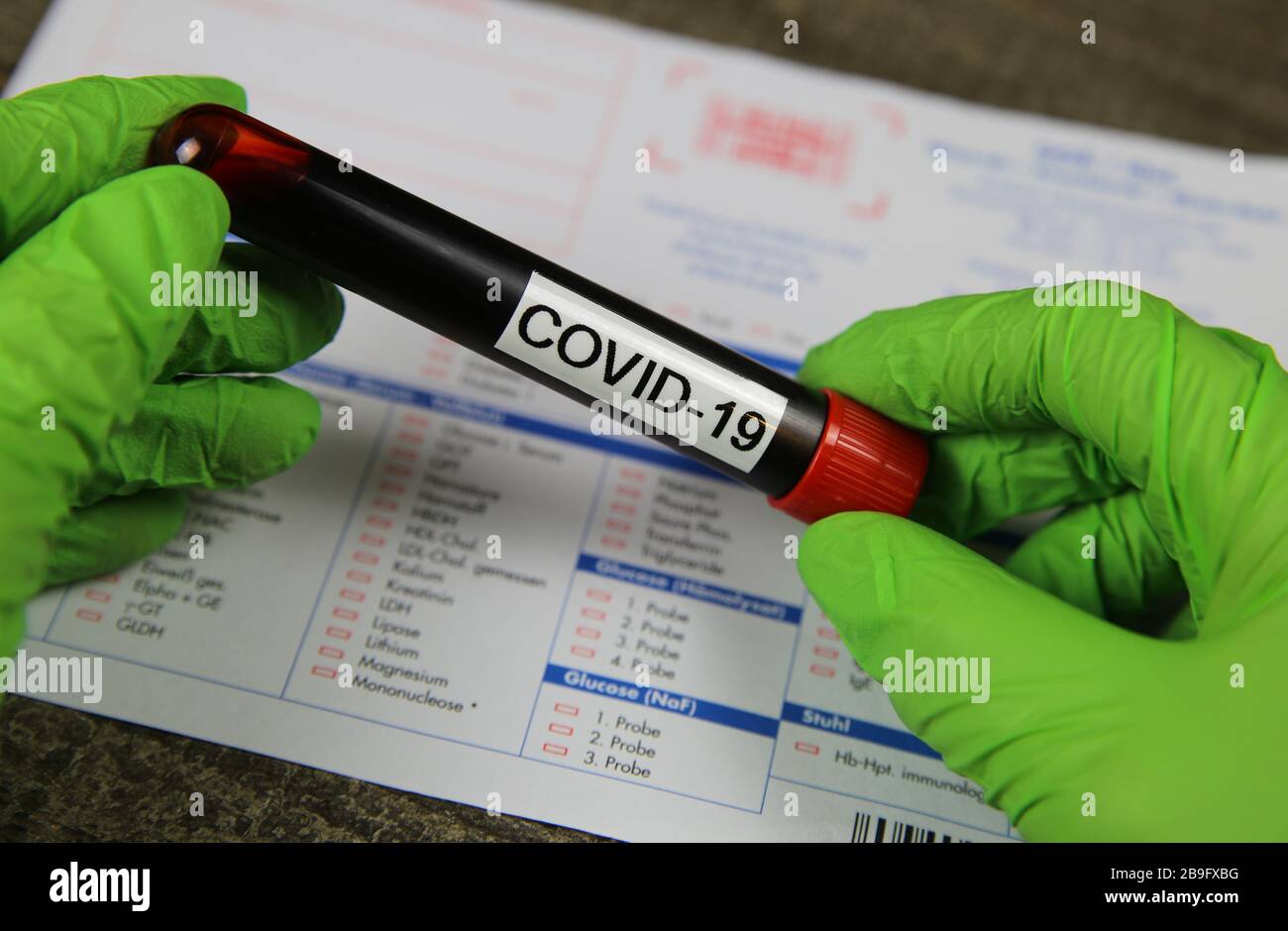 Viersen, Allemagne - 22 mars. 2020: Gros plan sur les mains isolées avec des gants verts tenant le flacon d'échantillon de sang avec le mot covid-19. Demande de test de laboratoire floue Banque D'Images