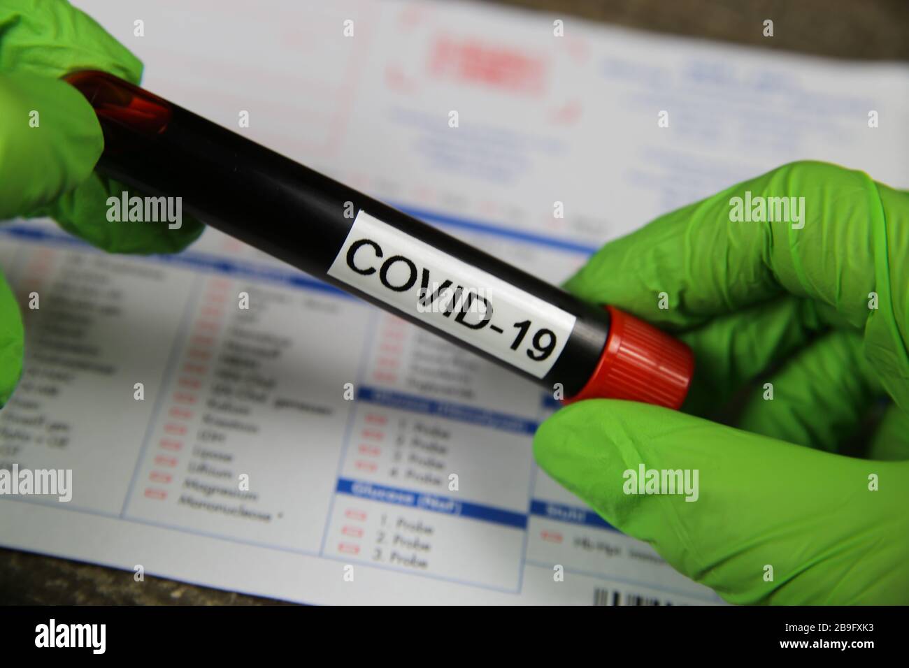 Viersen, Allemagne - 22 mars. 2020: Gros plan sur les mains isolées avec des gants verts tenant le flacon d'échantillon de sang avec le mot covid-19. Demande de test de laboratoire floue Banque D'Images