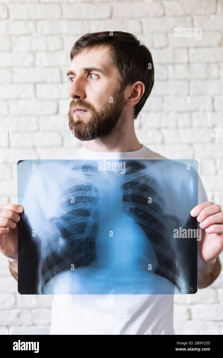 Jeune homme barbu tenant le film radiographique des poumons et du coeur devant sa poitrine, fond blanc. Orientation verticale Banque D'Images