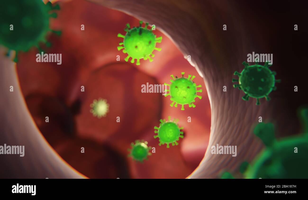 Le virus Corona ou les poumons humains infectés par Covid-19 - concept numérique tridimensionnel Banque D'Images