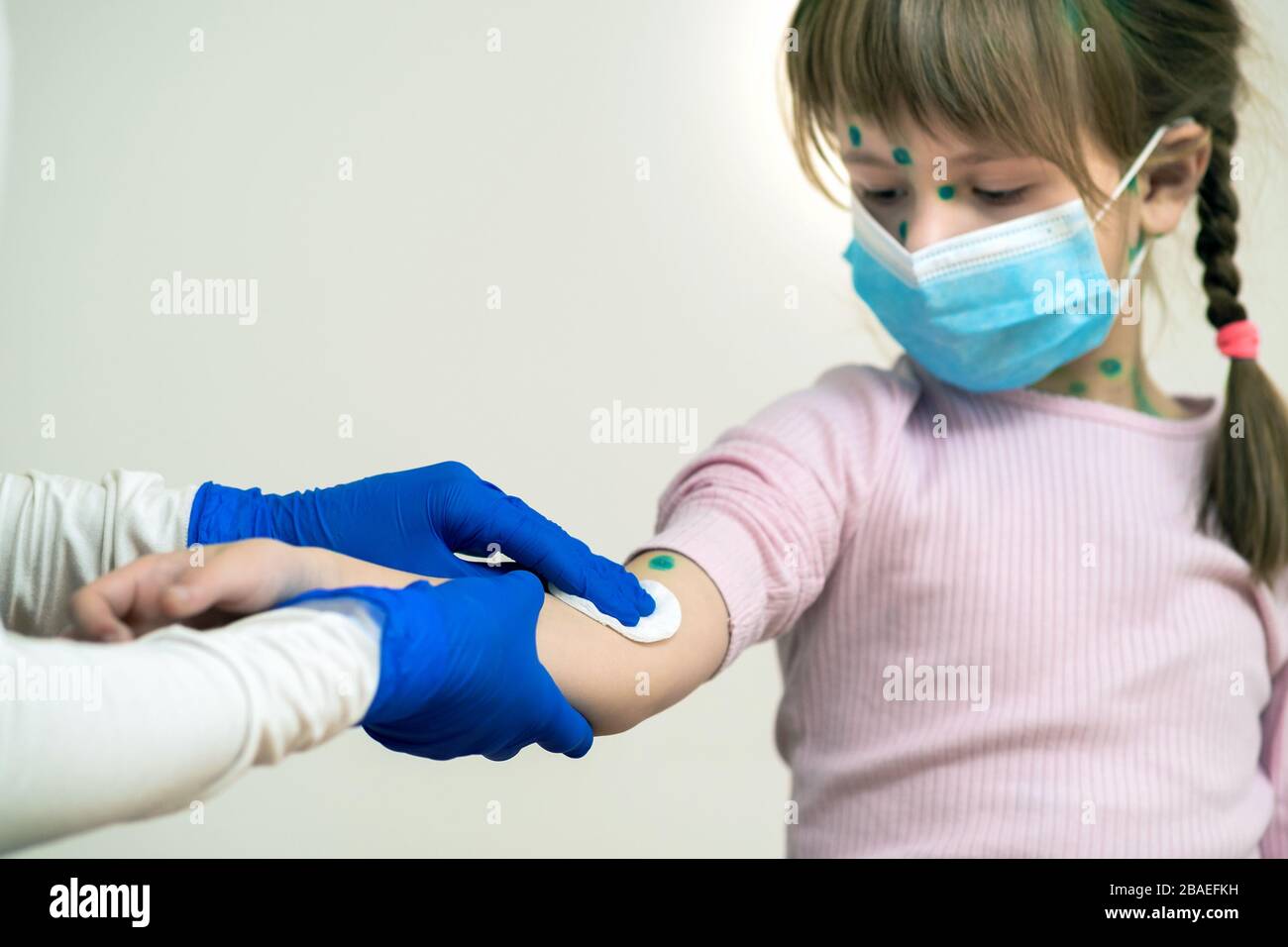 Mains de médecin faisant la désinfection préparer la main de fille d'enfant  à l'injection portant un masque médical bleu de protection malade avec la  varicelle, la rougeole ou le rubéole Photo Stock -