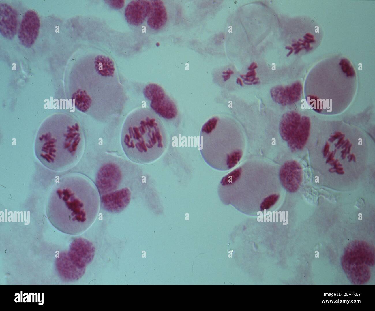 Chromosomes dans le noyau d'une cellule Banque D'Images
