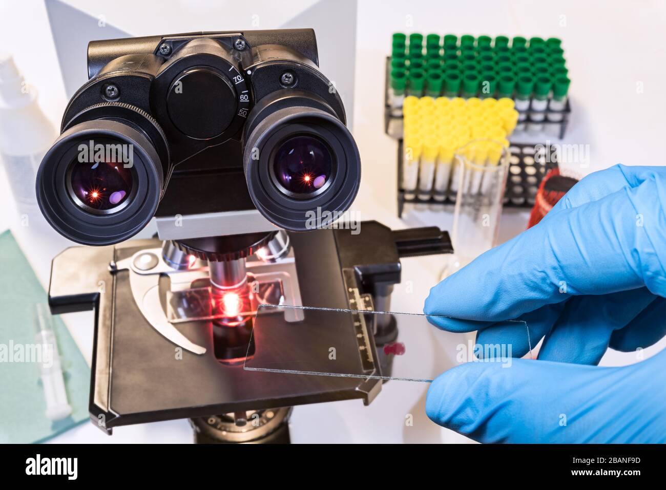 Maladie du coronavirus. Échantillon médical sur lame de microscope dans la main du médecin dans le gant bleu. Éclosion de Covid-19. Instrument médical optique de laboratoire et tubes à essai. Banque D'Images