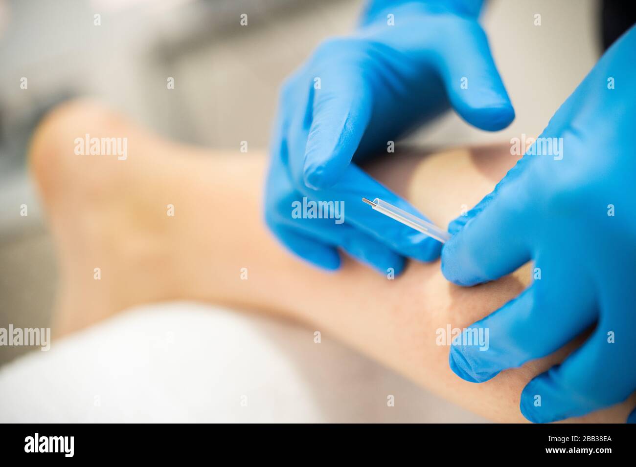 Mains de physiothérapeute faisant un aiguillage sec Banque D'Images