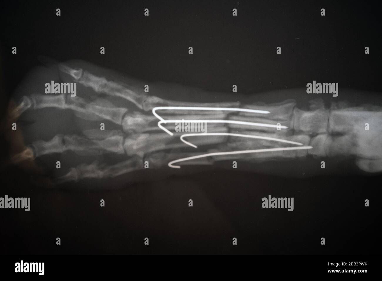Radiographie d'un chien paw. Image radiographique réelle d'une patte de chien blessée. Banque D'Images