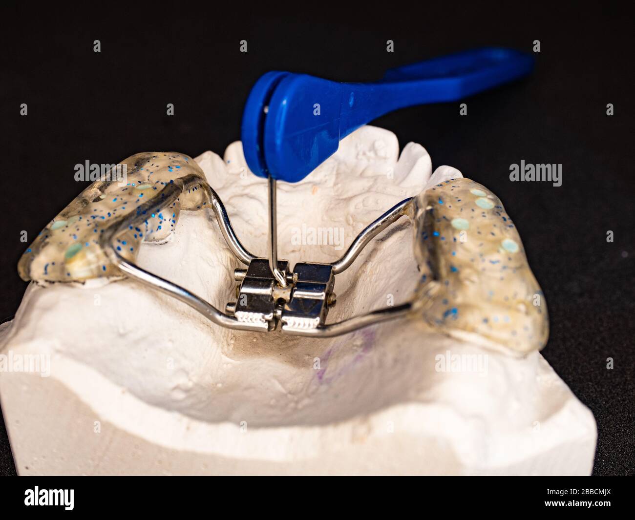 Réglage de test chez le dentiste des étrésillons palatales pour le jeune patient. La correction des mâchoires chez les jeunes est très populaire correction des malformations congénitales Banque D'Images
