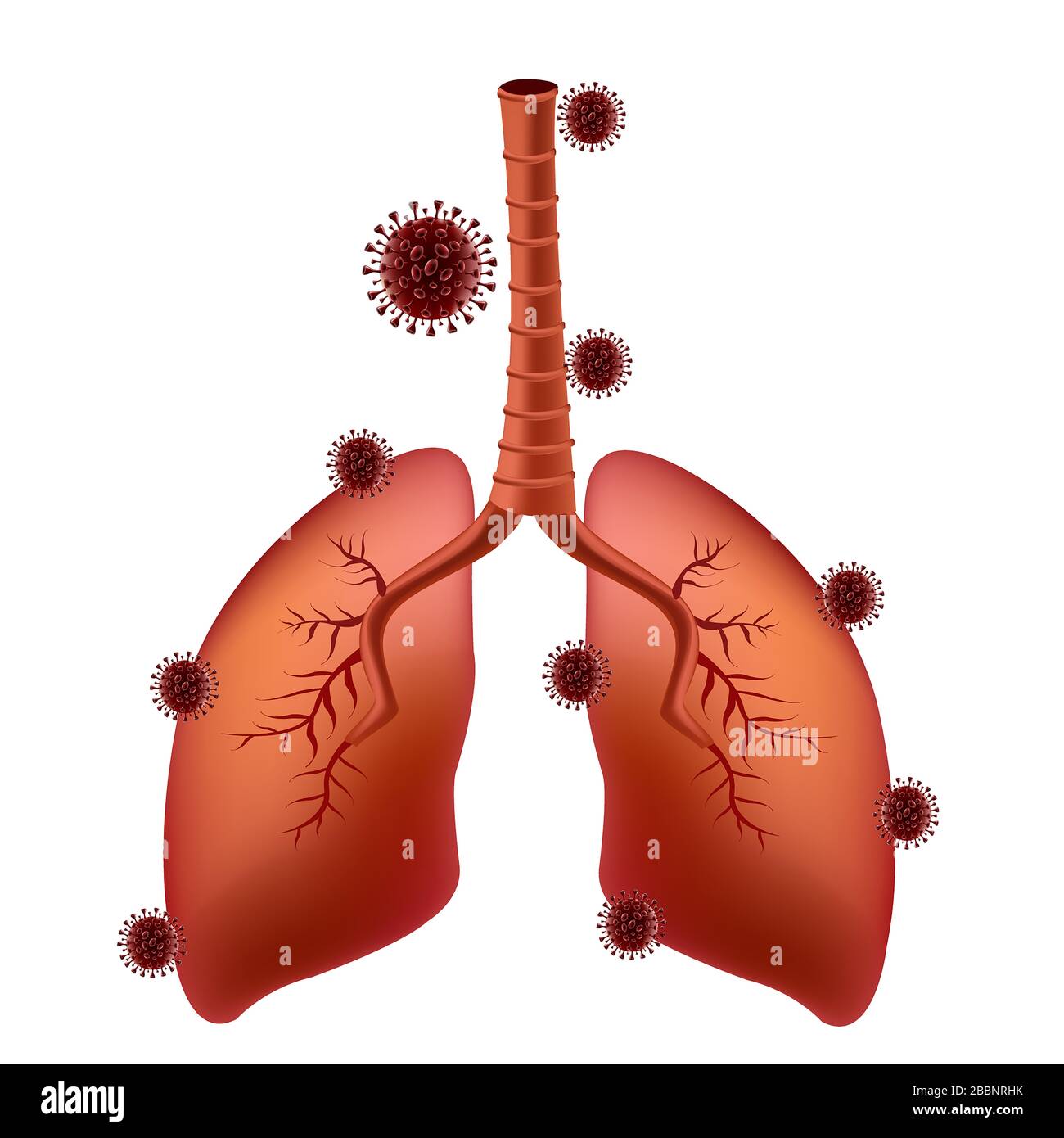 le virus corona covid-19 adhère aux poumons du patient pulmonaire Banque D'Images