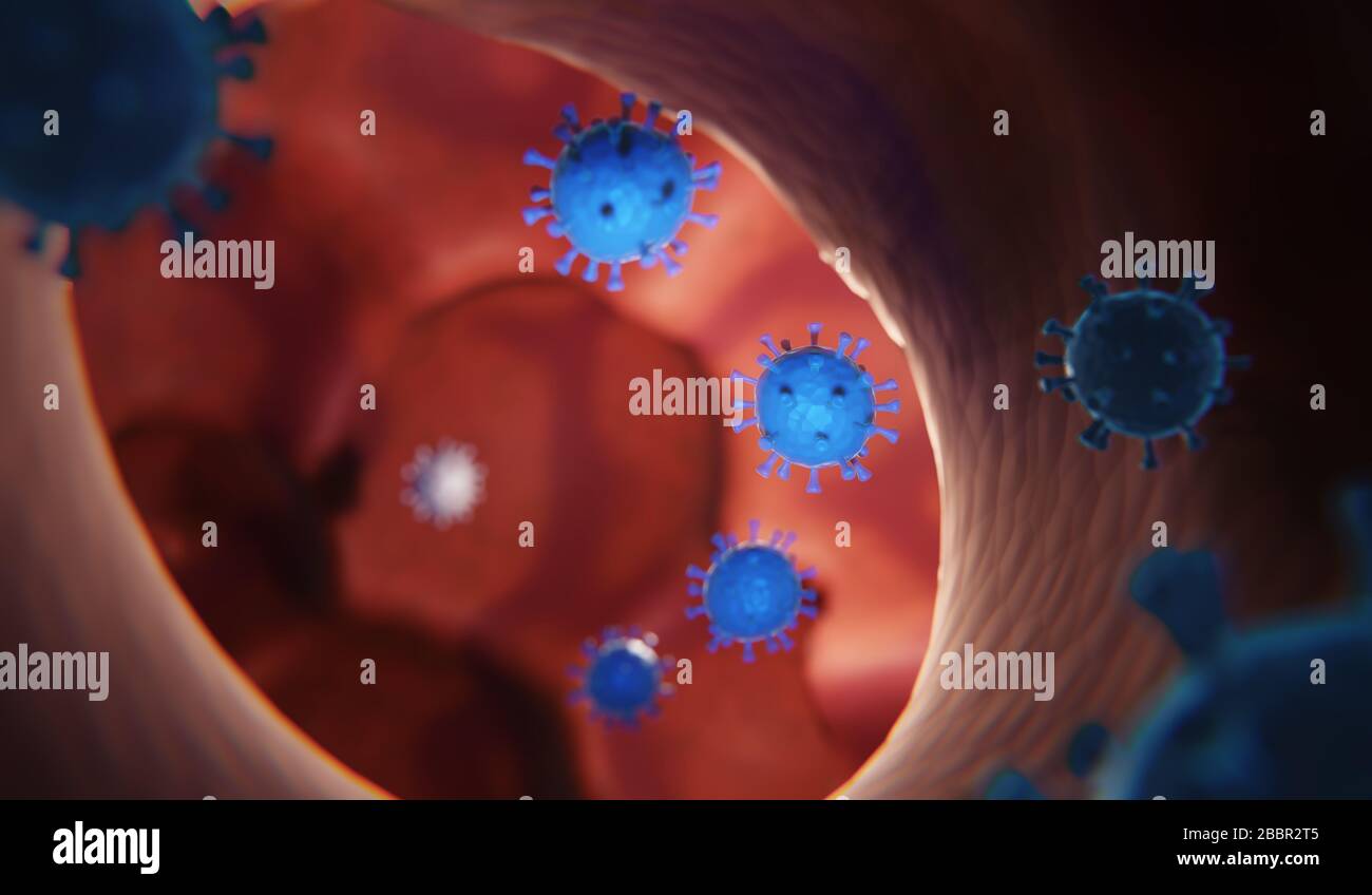 Le virus Corona ou les poumons humains infectés par Covid-19 - concept numérique tridimensionnel Banque D'Images