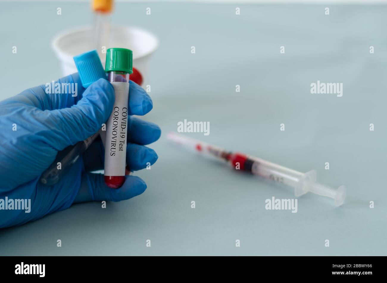 Tubes de test sanguin en laboratoire, échantillons sanguins, échantillon de sang de test covid-19, image conceptuelle. Banque D'Images