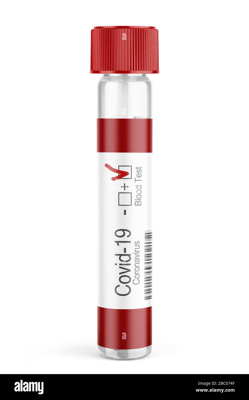 Échantillon de tube d'essai sanguin de coronavirus (Covid-19). Coronavirus Covid 19 résultat du test positif isolé contexte. Banque D'Images
