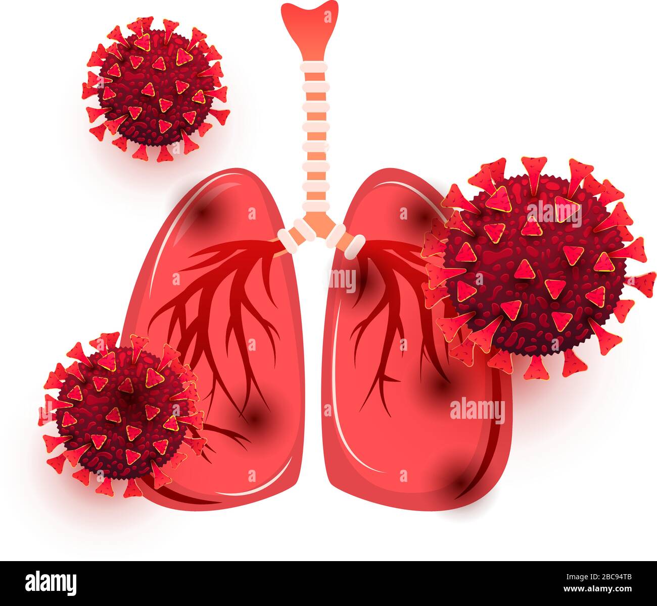 Infection du coronavirus pulmonaire. Infection du corps humain avec le virus mortel Covid 19 isolé sur un fond blanc Illustration de Vecteur