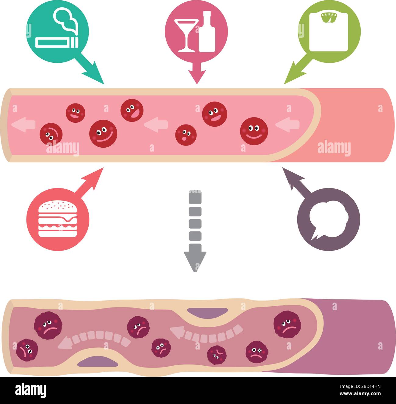 Illustration que le sang sain devient du sang boueux en raison de divers facteurs malsains, causant l'artériosclérose Illustration de Vecteur