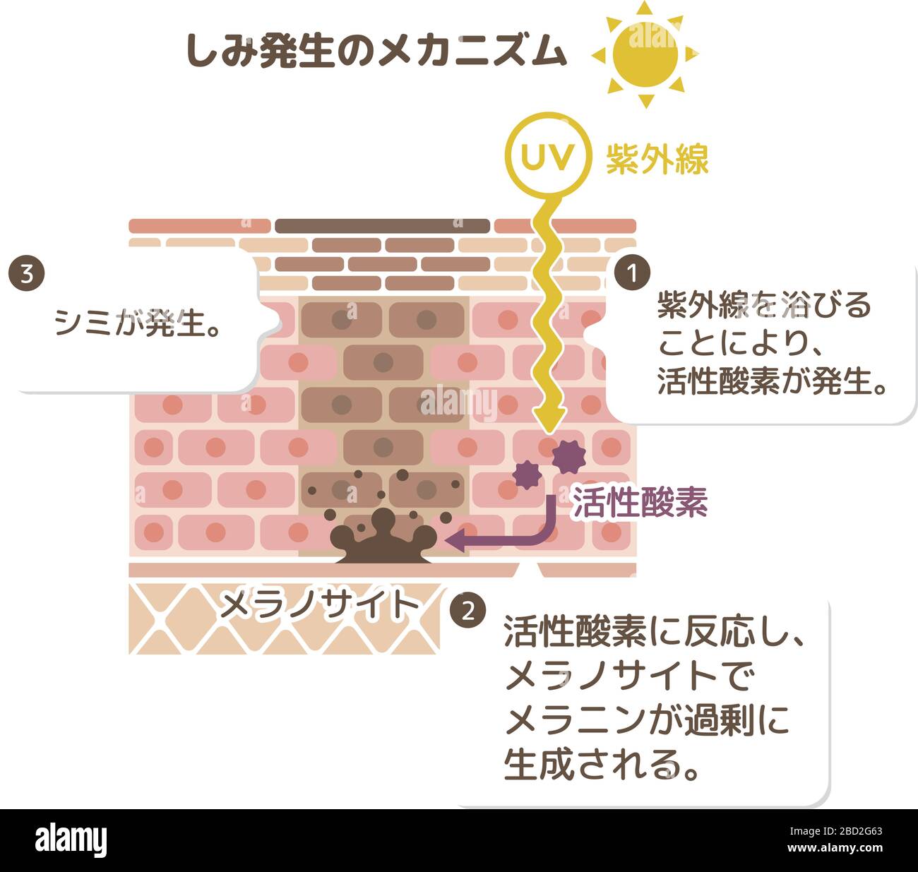 mécanisme de pigmentation de la peau / illustration de tache de peau Illustration de Vecteur
