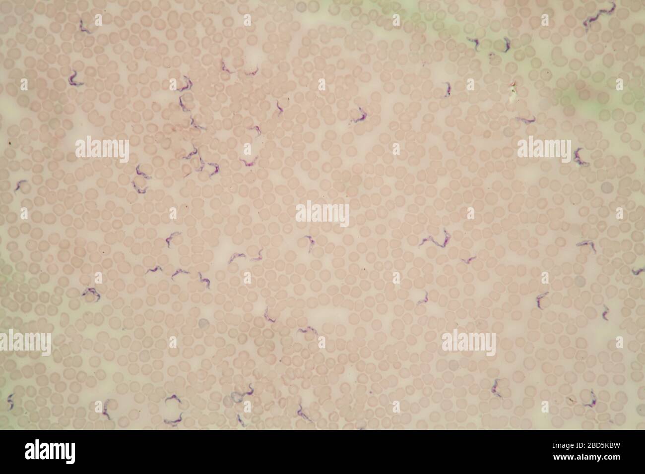 Trypanosomes des parasites de la maladie de Chagas dans le sang 400 fois Banque D'Images
