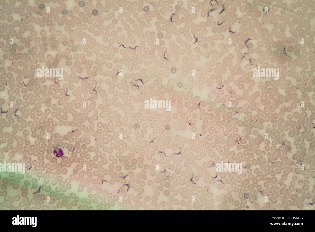 Trypanosomes des parasites de la maladie de Chagas dans le sang 400 fois Banque D'Images