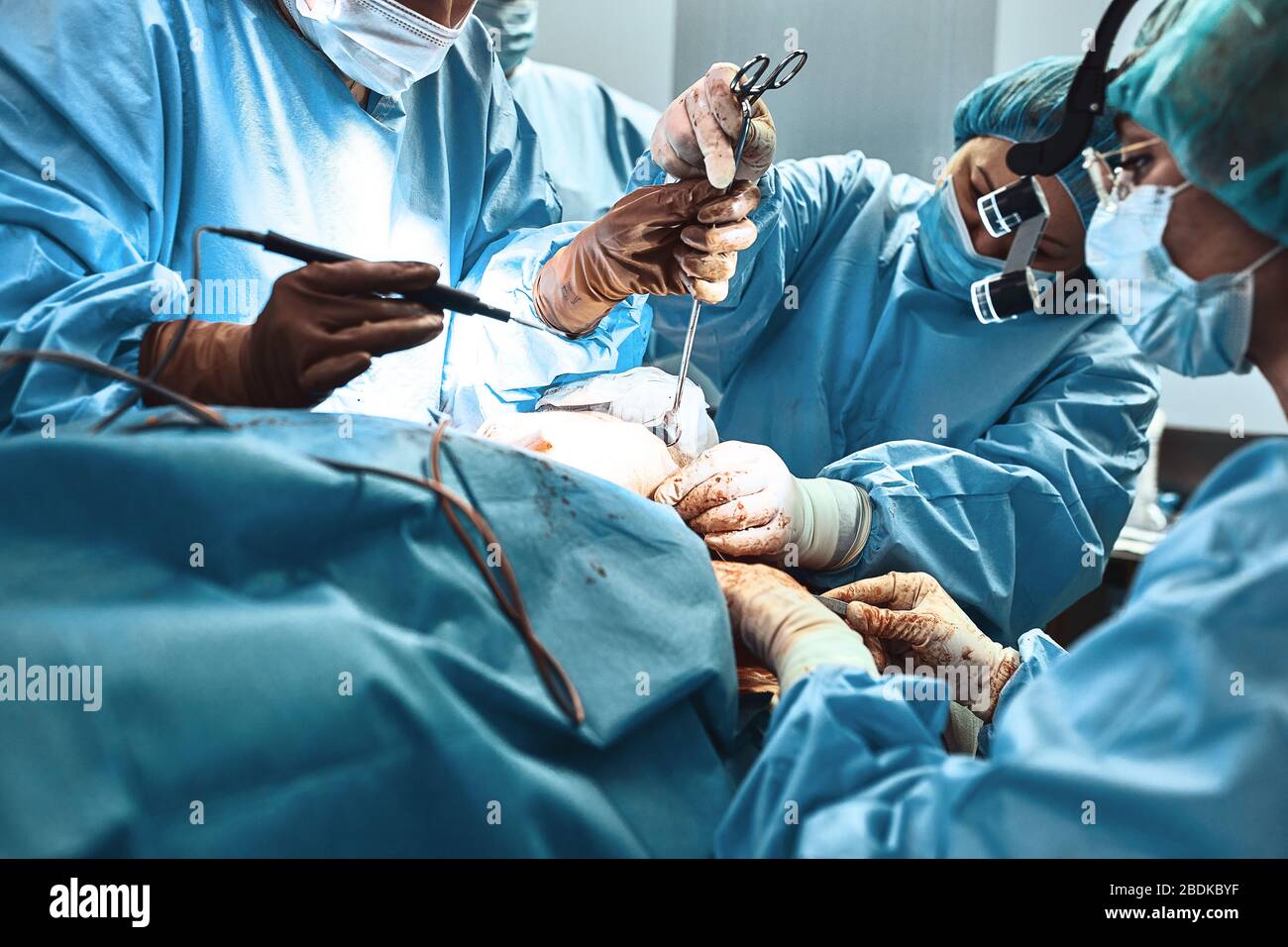 Une équipe de chirurgiens se bat pour la vie, une opération réelle, des émotions réelles. L'équipe de soins intensifs se bat pour la vie du patient. Sauver des vies Banque D'Images