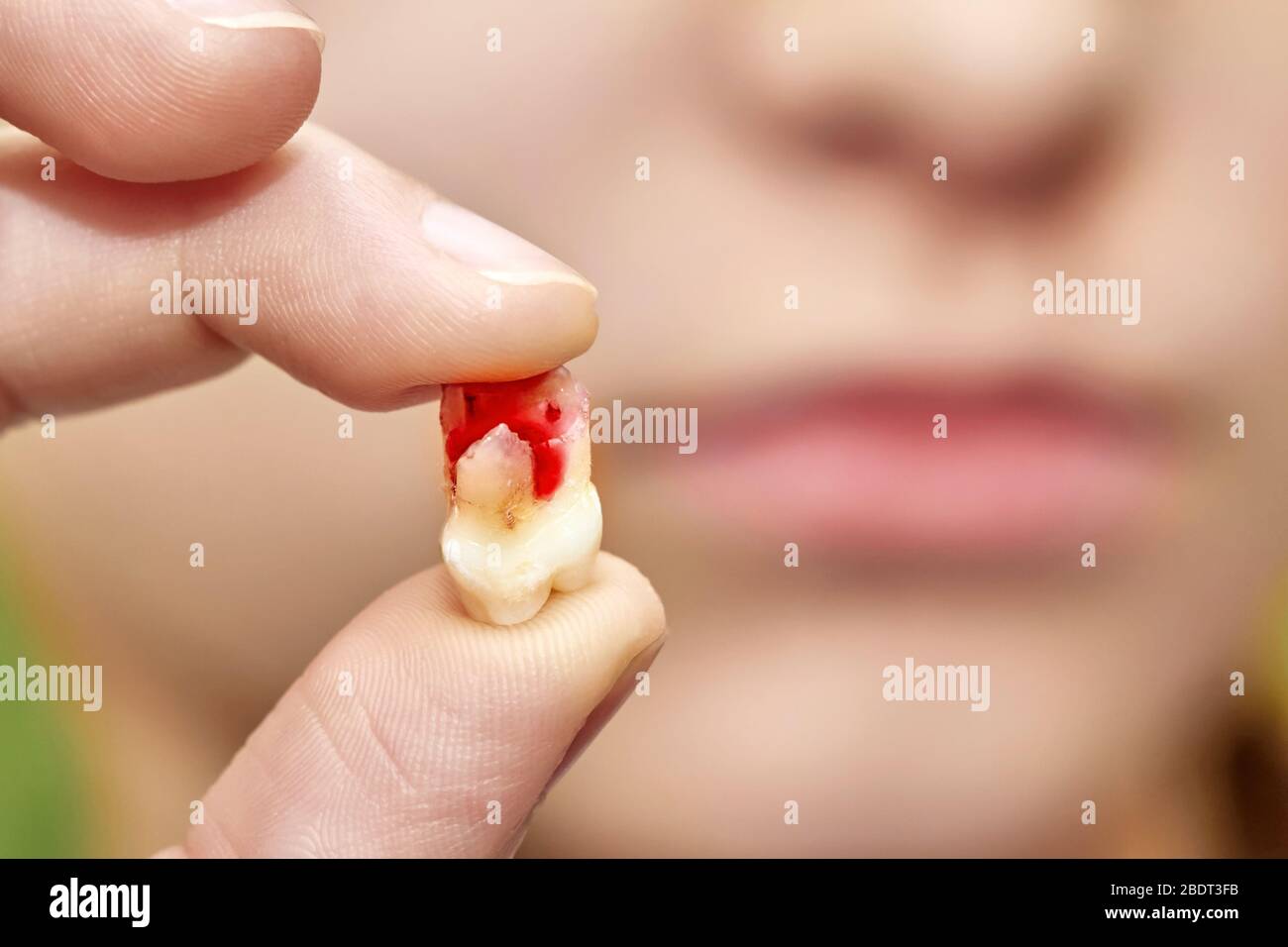 Une petite fille tient une dent tombée avec du sang dans sa main. Gros plan, mise au point sélective Banque D'Images