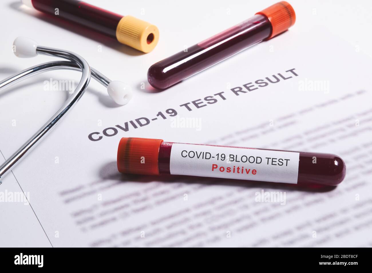 Résultat positif du test pour le coronavirus, test sanguin rapide pour le coronavirus ou la pandémie de Covid-19 Banque D'Images