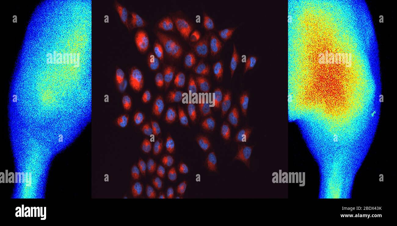 Les nanoparticules fournissent un agent d'imagerie Theranostic Banque D'Images