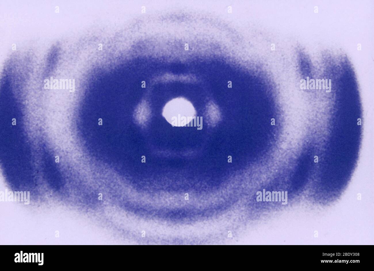 Rayons X précoces de l'ADN Banque D'Images