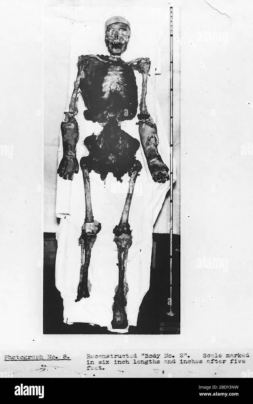 Reconstruction du squelette, meurtre de Buck Ruxton Banque D'Images