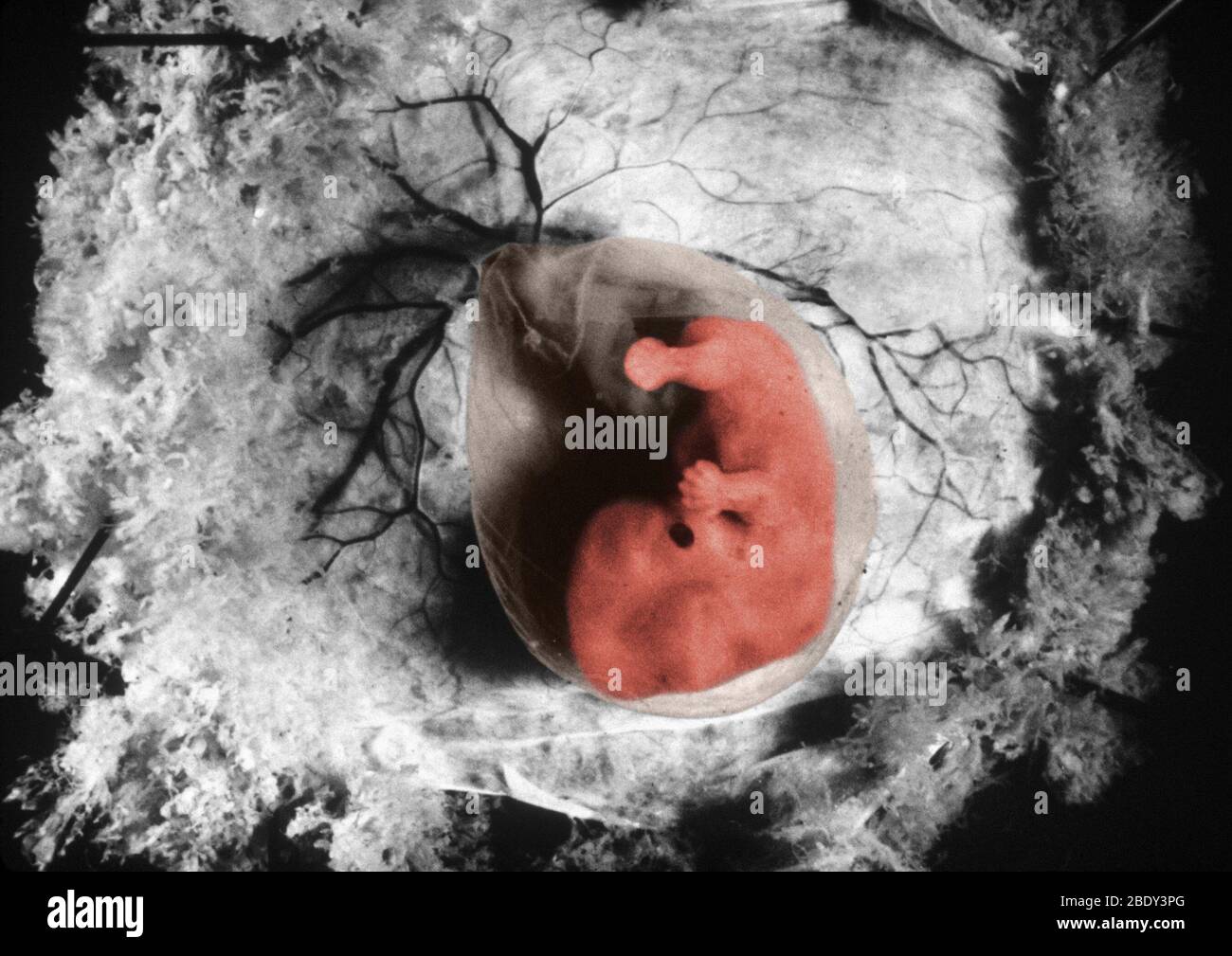 Embryon humain Banque D'Images
