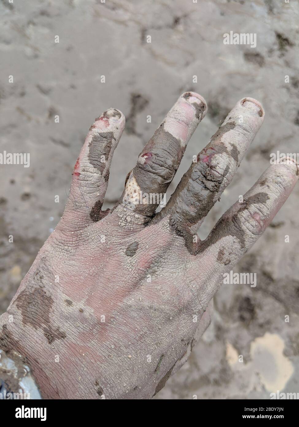 Homme montrant ses mains nues, boueux et bruisés. Doigts bruisés sanglants du cycliste après le cyclisme en vue rapprochée Banque D'Images