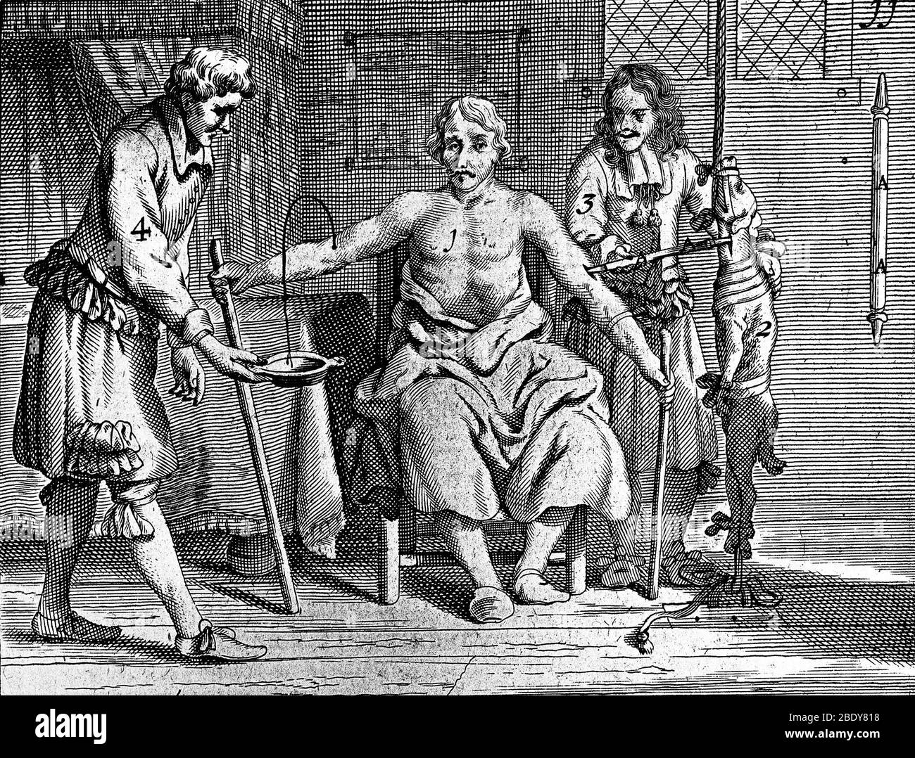Transfusionnelle du sang de chien à homme, 1692 Banque D'Images