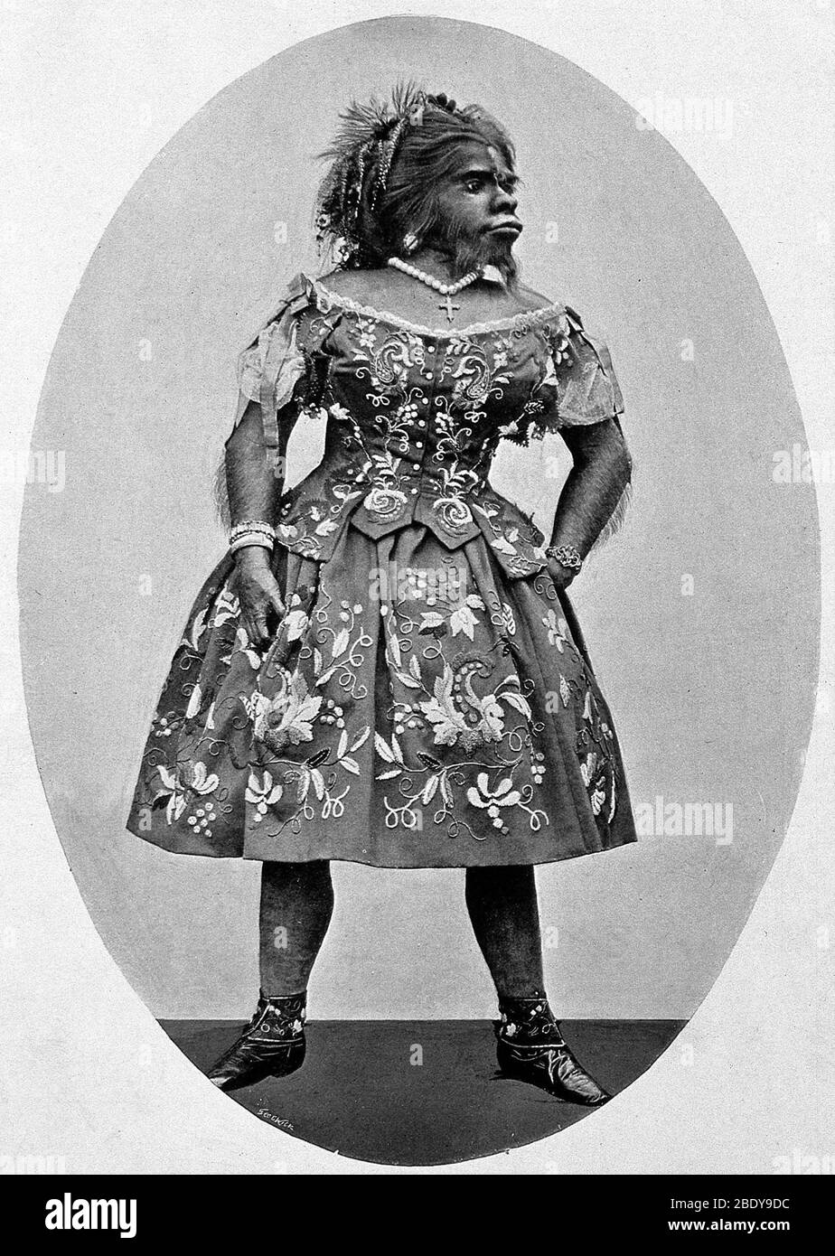 Hirsutisme Femme Banque De Photographies Et D images Haute R solution Hirsutisme Femme Banque De Photographies Et D images Haute R solution