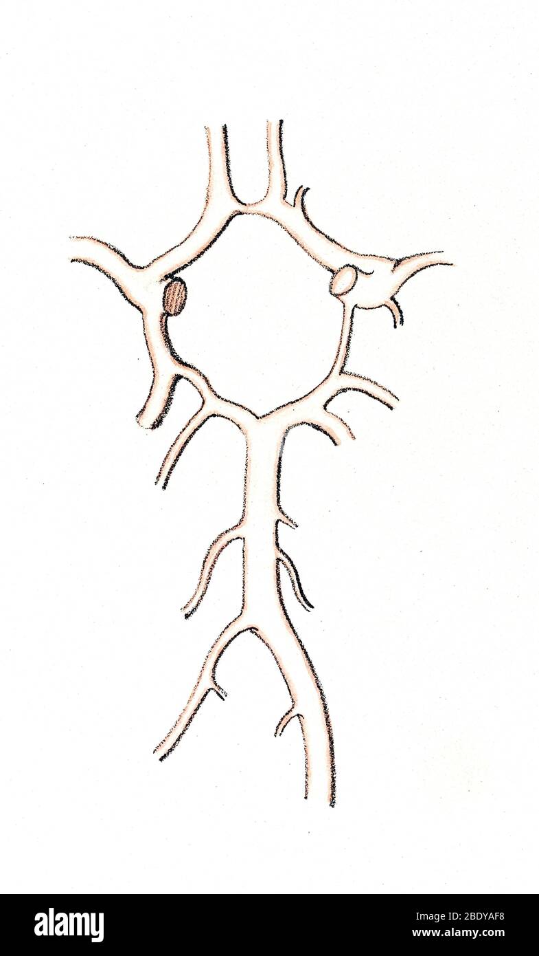 Artères à la base du cerveau, Cercle de Willis Banque D'Images