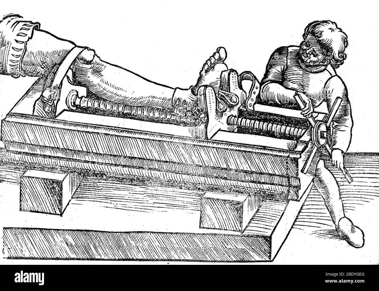 Réduction de la jambe délocalisée, XVIe siècle Banque D'Images