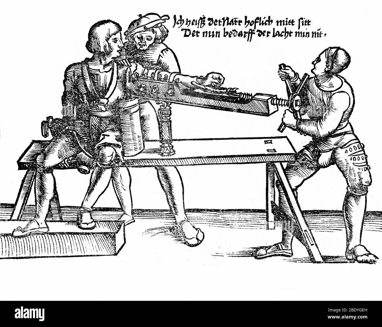 Réduction du bras dislocalisé, XVIe siècle Banque D'Images