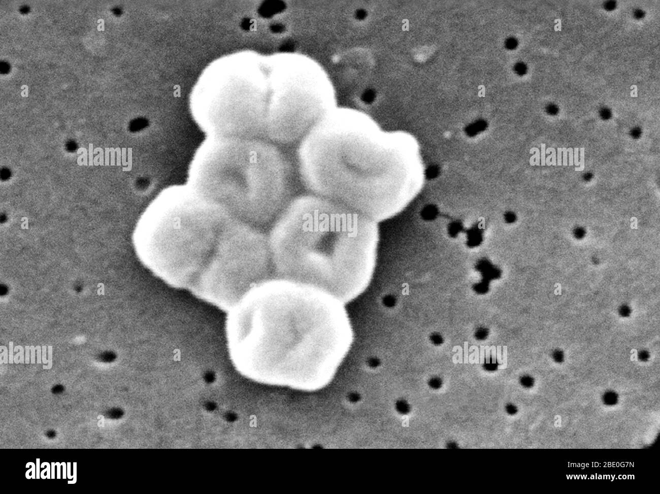 Ce mes représente un groupe fortement amplifié de bactéries Gram-négatives, non motiles Acinetobacter baumannii; Mag - 27600x. Les membres du genre Acinetobacter sont des tiges non motiles, de 1 à 1,5 µm de diamètre et de 1,5 à 2,5 µm de longueur, qui deviennent sphériques en forme pendant leur phase stationnaire de croissance. Acinetobacter spp. Sont largement distribués dans la nature et sont une flore normale sur la peau. Certains membres du genre sont importants parce qu'ils sont une cause émergente d'infections pulmonaires acquises à l'hôpital, c'est-à-dire les pneumoniae, les infections hémopathiques et les infections de la plaie. Banque D'Images