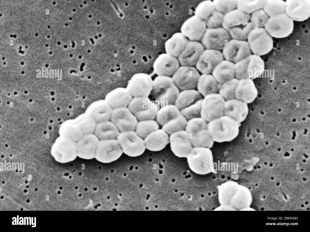 SEM représente un groupe fortement amplifié de bactéries Gram-négatives, non motiles Acinetobacter baumannii; Mag - 13331x. Les membres du genre Acinetobacter sont des tiges non motiles, de 1 à 1,5 µm de diamètre et de 1,5 à 2,5 µm de longueur, qui deviennent sphériques en forme pendant leur phase stationnaire de croissance. Acinetobacter baumannii est une espèce de bactéries pathogènes, appelée bactérie aérobie Gram-négative, résistante à la plupart des antibiotiques. En raison de sa résistance au traitement des médicaments, certaines estimations indiquent que la maladie tue chaque année des dizaines de milliers de patients hospitaliers américains. La maladie c Banque D'Images