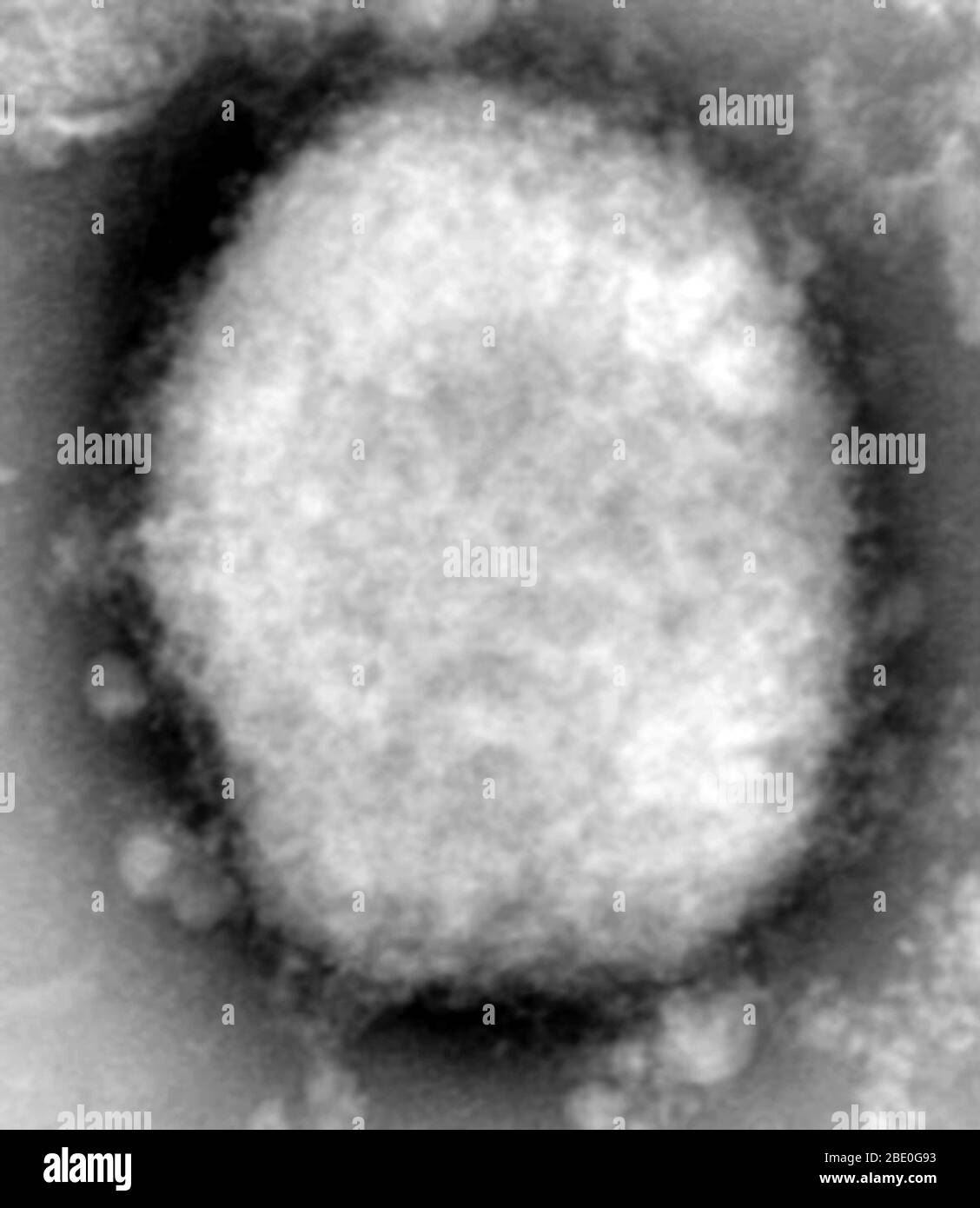 Virus de la variole de touche. Banque D'Images