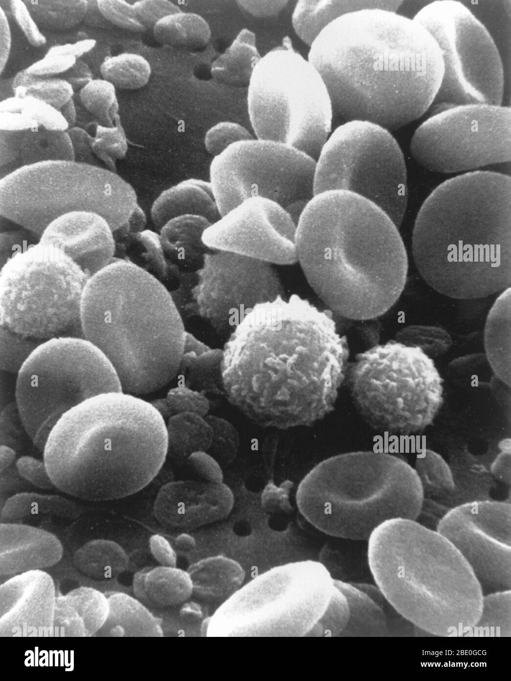 Cellules sanguines et plaquettes. Micrographe électronique à balayage (SEM) de sang humain montrant des cellules et plaquettes rouges et blanches. Les globules rouges (érythrocytes) ont une forme biconvexe-disque caractéristique et sont nombreux. Ces grandes cellules contiennent de l'hémoglobine, un pigment rouge par lequel l'oxygène est transporté autour du corps. Ils sont plus nombreux que les globules blancs dont l'une est visible dans cet échantillon. Les globules blancs (leucocytes) sont des cellules arrondies avec des projections de microvillosités à partir de la surface cellulaire. Les leucocytes jouent un rôle important dans la réponse immunitaire du corps. Les plaquettes sont des cellules plus petites qui Banque D'Images