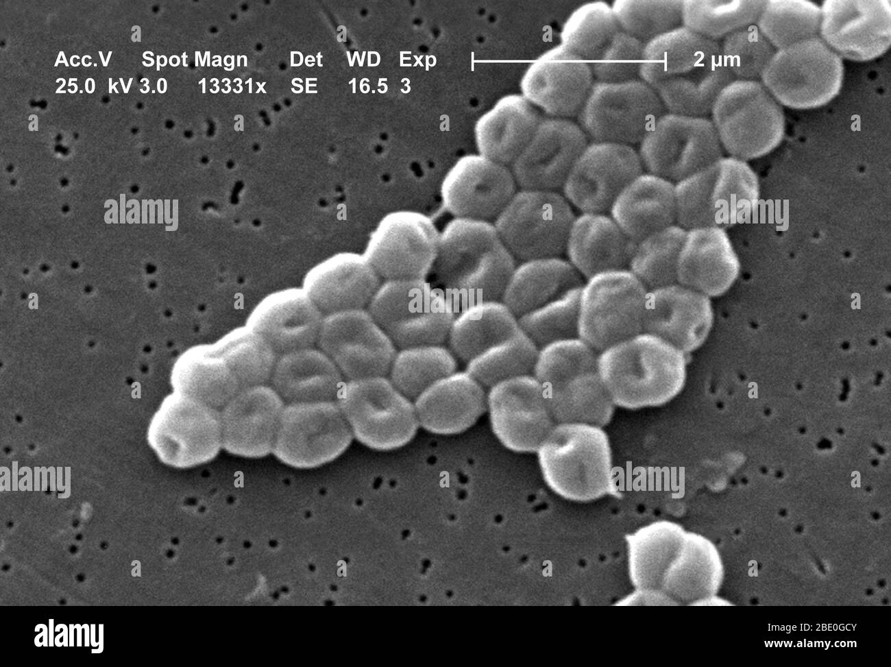 Ce mes représente un groupe fortement amplifié de bactéries Gram-négatives, non motiles Acinetobacter baumannii; Mag - 13331x. Les membres du genre Acinetobacter sont des tiges non motiles, de 1 à 1,5 µm de diamètre et de 1,5 à 2,5 µm de longueur, qui deviennent sphériques en forme pendant leur phase stationnaire de croissance. Acinetobacter spp. Sont largement distribués dans la nature et sont une flore normale sur la peau. Certains membres du genre sont importants parce qu'ils sont une cause émergente d'infections pulmonaires acquises à l'hôpital, c'est-à-dire les pneumoniae, les infections hémopathiques et les infections de la plaie. Banque D'Images