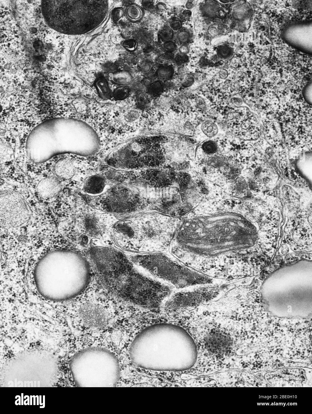Micrographe électronique de transmission (TEM) des lysosomes. Un lysosome est une organelle liée à la membrane que l'on trouve dans presque toutes les cellules animales. Ce sont des vésicules sphériques qui contiennent des enzymes hydrolytiques qui peuvent décomposer pratiquement tous les types de biomolécules (déchets et débris cellulaires). Le nom lysosome dérive des mots grecs lyse, à séparer, et soma, corps. Ils sont souvent surappelés « sacs-fongicides » ou « sacs-fongicides » par des biologistes cellulaires en raison de leur rôle dans l'autolyse, plus communément appelée auto-digestion, se réfère à la destruction d'une cellule par l'action de ses propres enzymes. Magni Banque D'Images