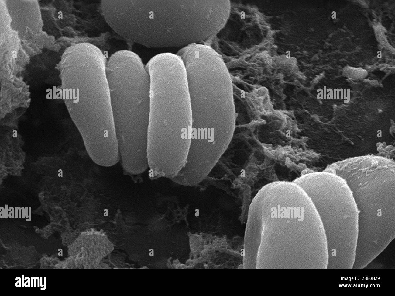 Ce micrographe électronique à balayage (SEM) a illustré une vue plus rapprochée d'un certain nombre de globules rouges trouvés enmaillés dans une matrice fibreuse sur la surface luminale d'un système vasculaire à indwelling; agrandi 7766 fois. Dans ce cas, le cathéter d'endwelling était un tube qui était laissé en place créant un portail de brevet directement dans un vaisseau sanguin. Certaines érythrocytes sont regroupés dans une pile appelée formation de routeaux. Notez la forme cytomorphologique biconvexe de chaque érythrocyte, qui augmente la surface de ces cellules remplies d'hémoglobine, favorisant ainsi un plus grand degré d'échange de gaz, qui est t Banque D'Images