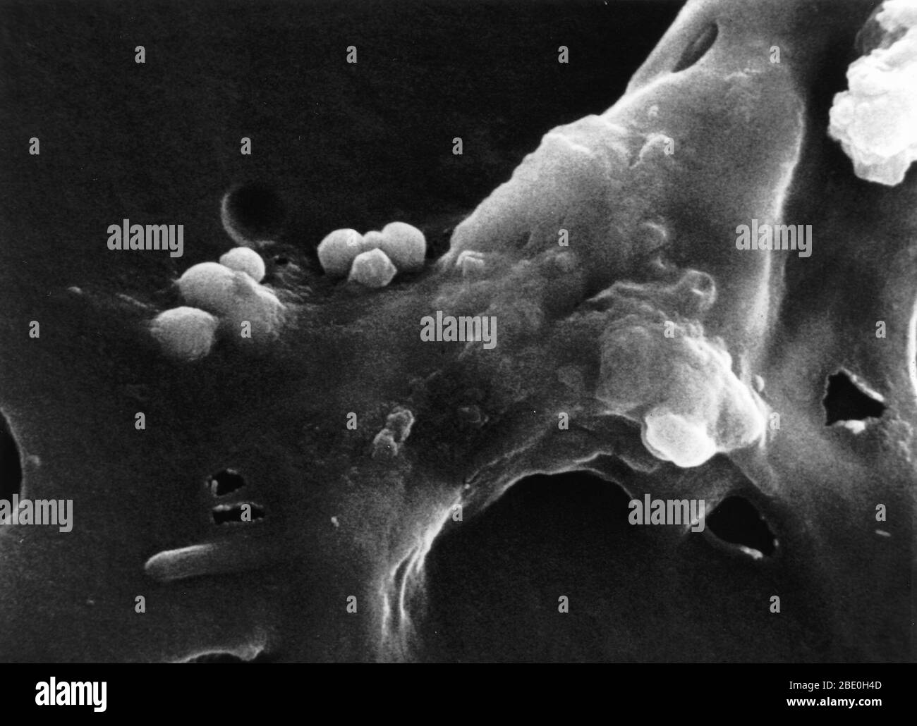 Étape quatre d'une séquence en six étapes de la mort d'une cellule cancéreuse. La cellule commence à arrondir et perd ses pics lorsque la cellule macrophage devient lisse. Agrandissement de la photo : 26 000 fois Banque D'Images