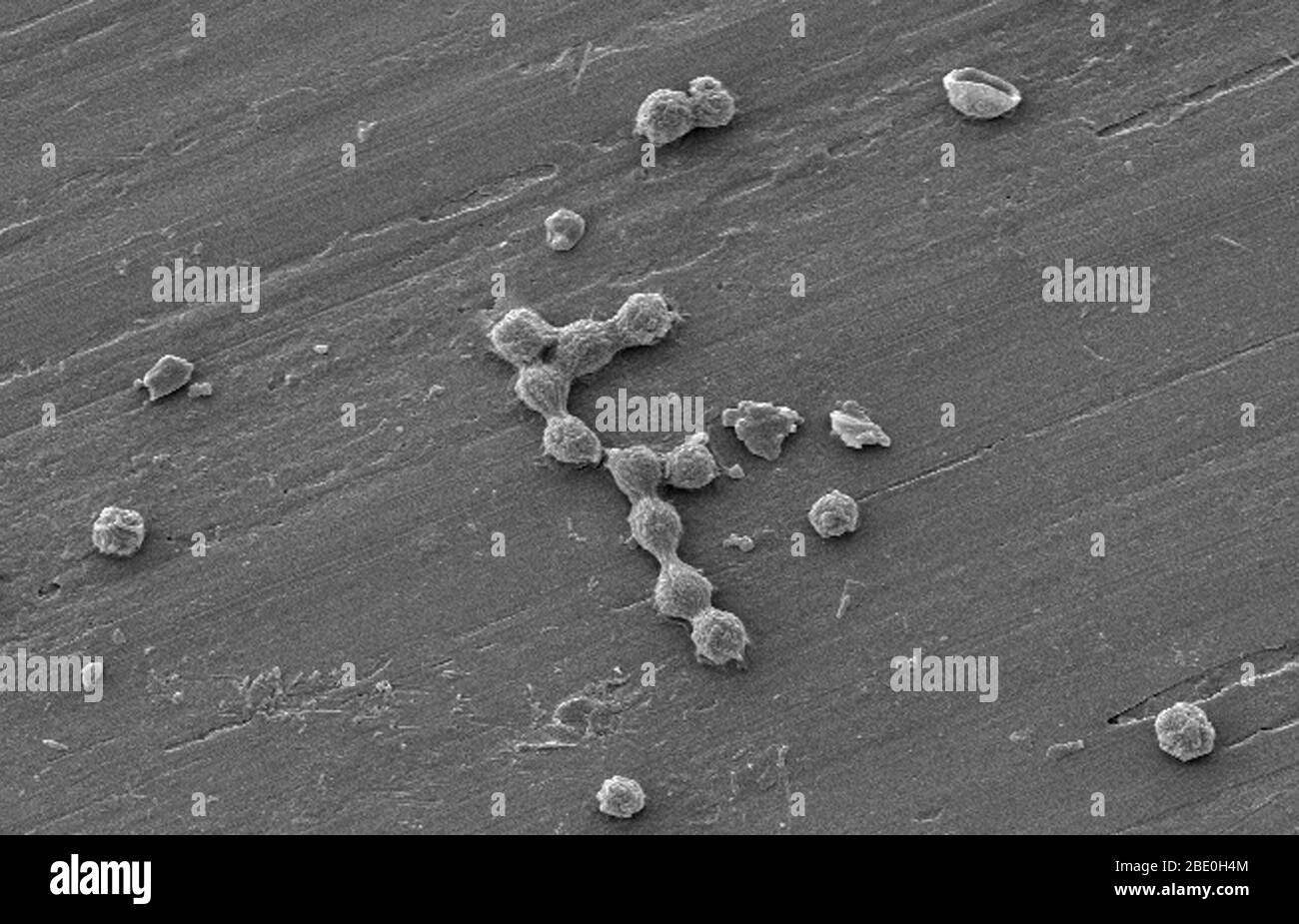 Les amibes libres (FLA) du groupe Amoebozoa sont des causes importantes de maladies chez les humains et les animaux. Couleur améliorée SEM d'un biofilm d'eau potable (potable) cultivé en laboratoire, avec la présence de kystes de Vermamoeba vermiformis (Hartmanella). Les bactéries aquatiques ont été cultivées comme biofilm sur l'acier pendant une semaine. V. vermiformis a ensuite été ajouté, et phagocytisé la bactérie qui s'est multipliée dans les vésicules qui sont devenues des kystes dans lesquels la bactérie vivra jusqu'à ce qu'elle se rupture. Vermamoeba vermiformis est une amibe libre-vivant (FLA), est de nature répandue et a été isolée du sol, de l'eau douce, de l'air, et un Banque D'Images