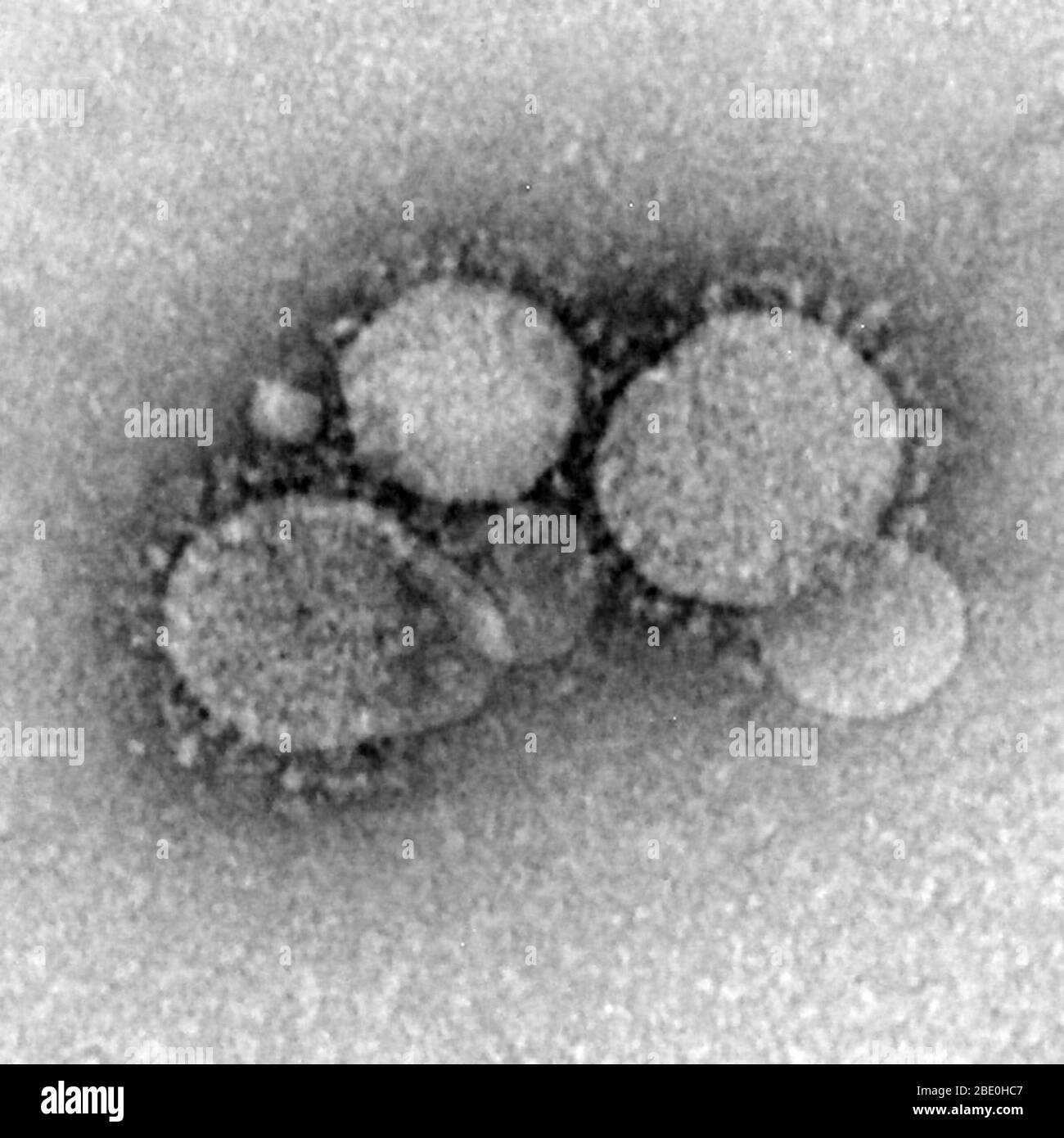 Micrographe électronique de transmission à coloration négative (TEM) du coronavirus du syndrome respiratoire du Moyen-Orient (MERS-CoV), un nouveau coronavirus (nCoV), présenté pour la première fois le 24 septembre 2012 par le virologue égyptien Ali Mohamed Zaki à Djeddah, en Arabie Saoudite. Il a isolé et identifié un coronavirus précédemment inconnu des poumons d'un patient mâle de 60 ans souffrant d'une pneumonie aiguë et d'une insuffisance rénale aiguë. Le MERS-COV est le sixième nouveau type de coronavirus comme le SRAS (mais il est encore distinct de celui-ci et du coronavirus à froid commun). Les viriers contiennent des projections caractéristiques de type club émanant de Banque D'Images