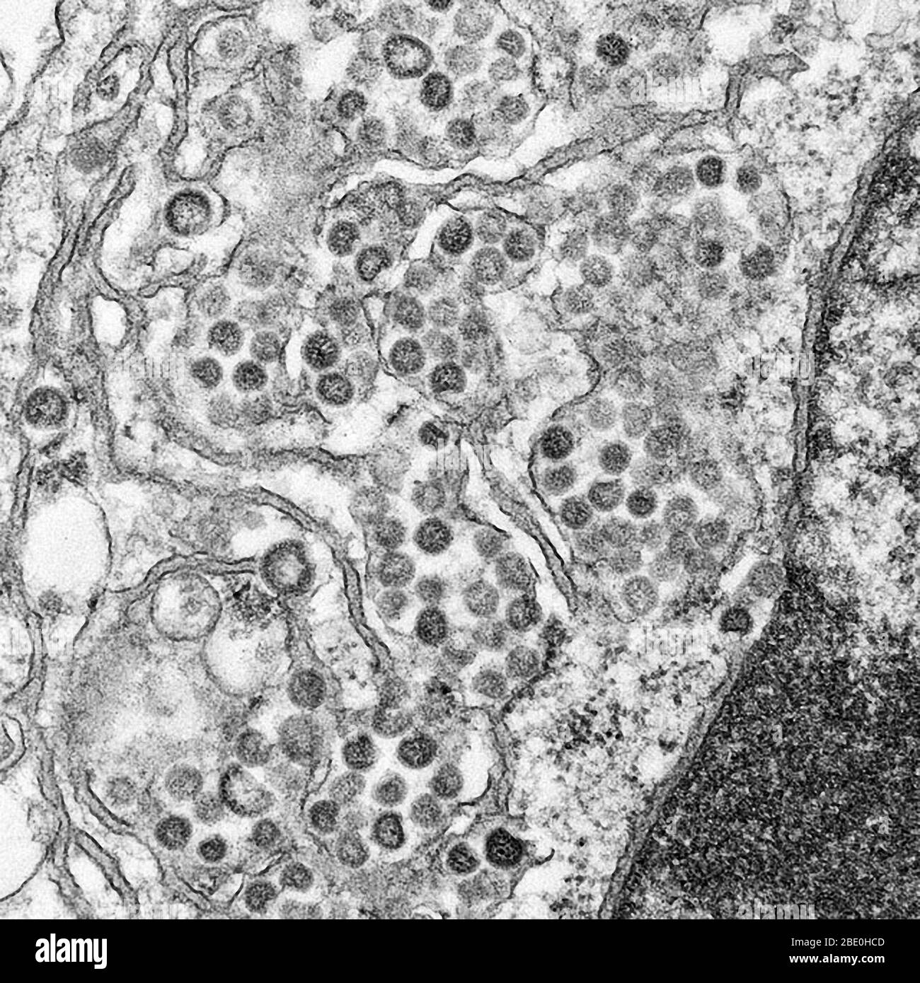 Micrographe électronique de transmission (TEM) d'une section mince du MERS-CoV, montrant les particules sphériques et les sections transversales à travers le nucléocapsid viral. Le coronavirus du syndrome respiratoire du Moyen-Orient (MERS-CoV) est un nouveau coronavirus (nCoV) signalé pour la première fois le 24 septembre 2012 par le virologue égyptien Ali Mohamed Zaki à Djeddah, en Arabie Saoudite. Il a isolé et identifié un coronavirus précédemment inconnu des poumons d'un patient mâle de 60 ans souffrant d'une pneumonie aiguë et d'une insuffisance rénale aiguë. Le MERS-COV est le sixième nouveau type de coronavirus comme le SRAS (mais il est encore distinct de celui-ci et du commun-c) Banque D'Images