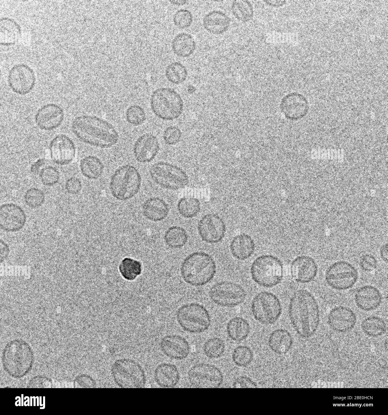 Transmission micrographe électronique (TEM) du médicament de chimiothérapie doxorubicine encapsulé dans le liposome, nom commercial Doxil. Agrandissement inconnu. Banque D'Images