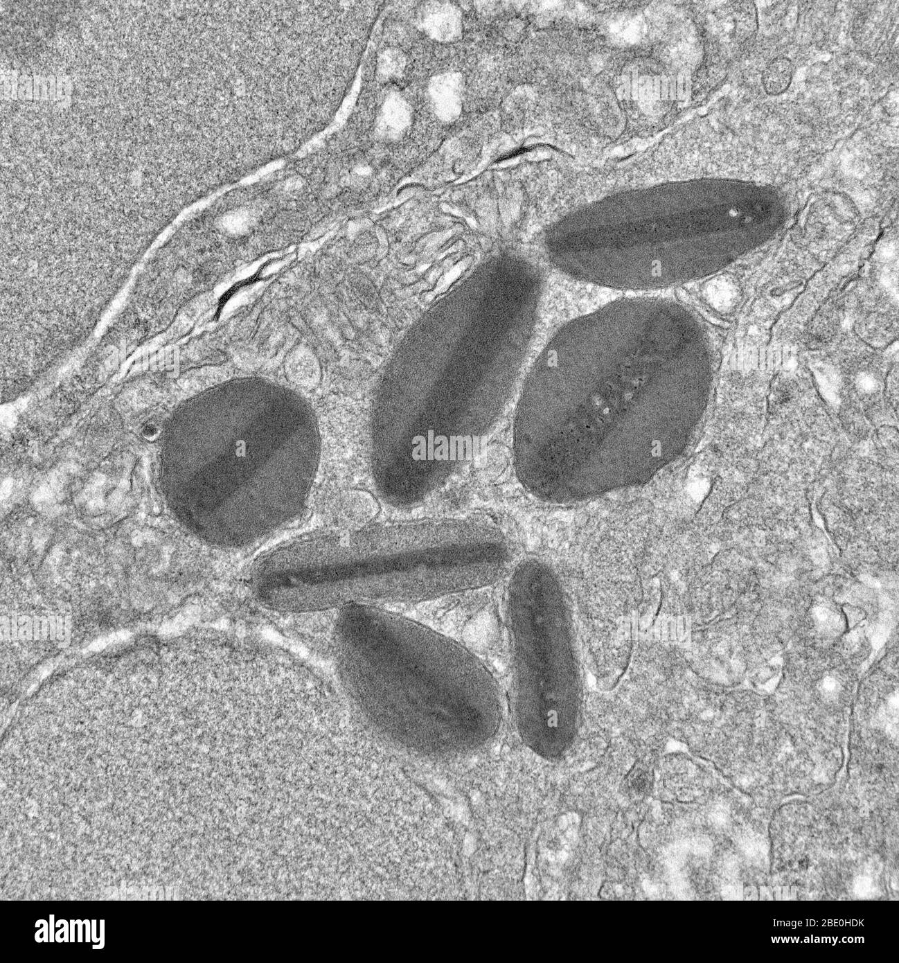 Micrographe d'électrons de transmission montrant des granules d'éosinophiles, un type de cellule blanche. Les éosinophiles, parfois appelés éosinophiles ou, moins souvent, acidophiles, sont une variété de globules blancs et l'un des composants du système immunitaire responsables de la lutte contre les parasites multicellulaires et certaines infections chez les vertébrés. Avec les mastocytes et les basophiles, ils contrôlent également les mécanismes associés à l'allergie et à l'asthme. Ce sont des granulocytes qui se développent pendant l'hématopoïèse dans la moelle osseuse avant de migrer dans le sang. Agrandissement inconnu. Banque D'Images