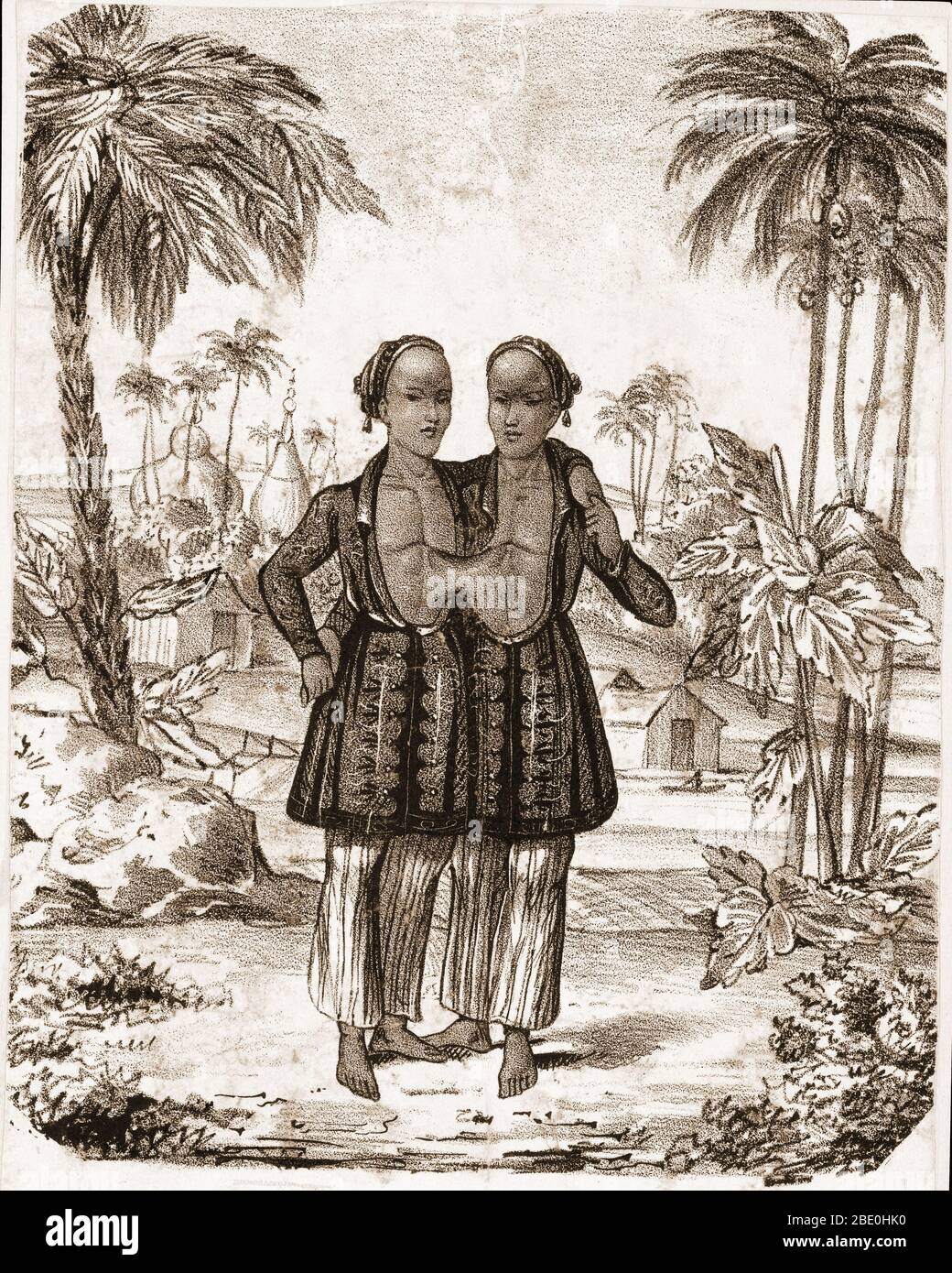 Chang et Eng Bunker (11 mai 1811 - 17 janvier 1874) étaient les frères jumeaux conjoints dont la condition et le lieu de naissance sont devenus la base du terme 'jumeaux siamois'. En 1829, ils ont été découverts par le marchand britannique Robert Hunter et exposés comme une curiosité pendant une tournée mondiale. À la résiliation de leur contrat, ils sont devenus naturalisés citoyens des États-Unis, installés sur une plantation, ont acheté des esclaves et adopté le nom de Bunker' les jumeaux sont morts le même jour en janvier 1874. Chang, qui avait contracté la pneumonie, est mort subitement dans son sommeil, mais Eng a refusé d'être séparé de son frère mort Banque D'Images