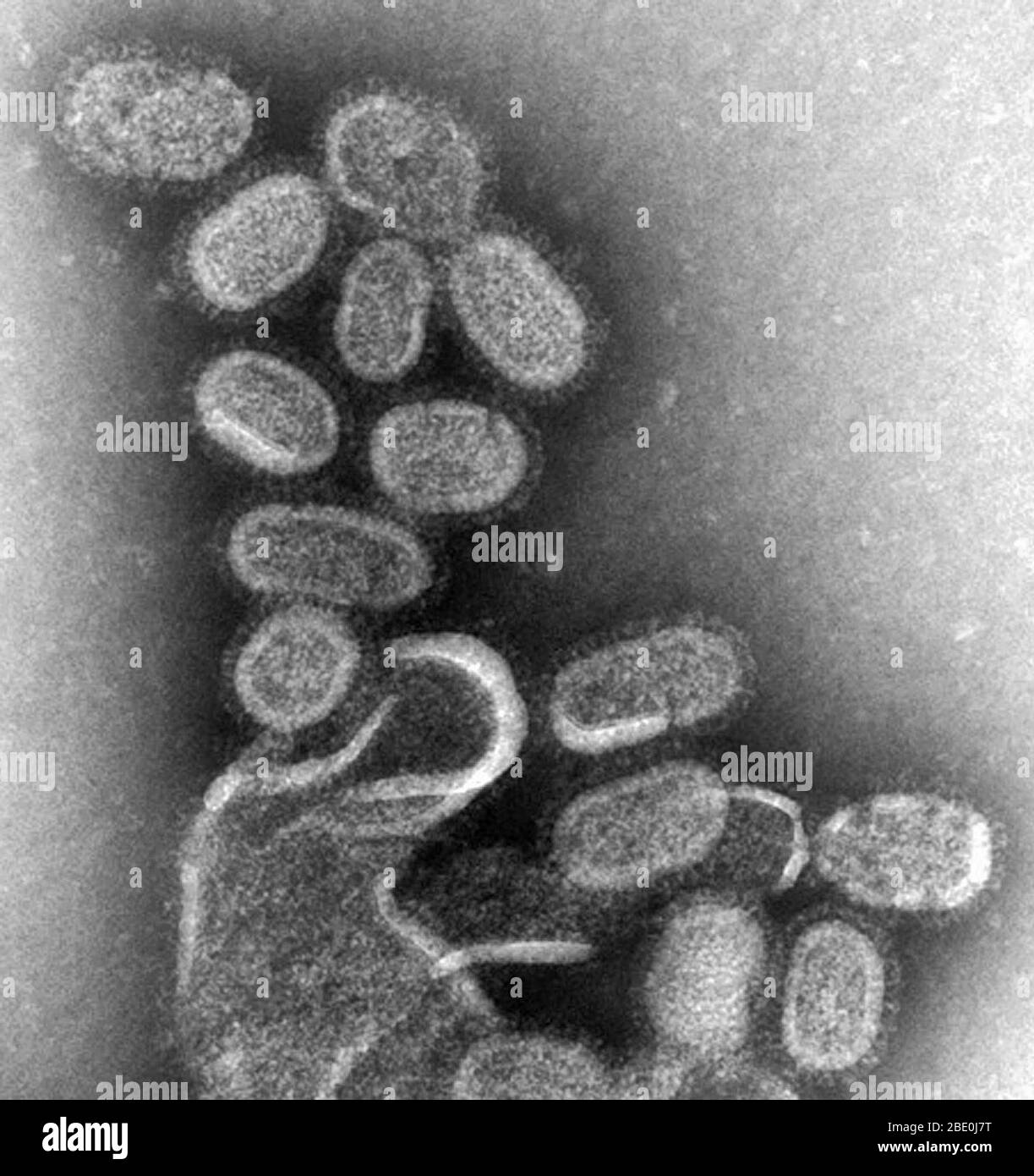 Le TEM coloré par des négatifs montre des virions de l'influenza recréés en 1918 qui ont été recueillis à partir du surnageant d'une culture cellulaire de Madin-Darby Canine Kidney (MDCK) infectée en 1918, 18 heures après l'infection. Afin de séquestrer ces virons, les cellules MDCK ont été essorées (centrifugation) et le virus de 1918 présent dans le liquide a été fixé pour coloration négative. Le Dr Terrence Tumpey, microbiologiste du personnel et membre du Centre national des maladies infectieuses (NCID), a recréé le virus de l'influenza de 1918 afin d'identifier les caractéristiques qui ont fait de cet organisme un pathogène si mortel. Efforts de recherche Banque D'Images