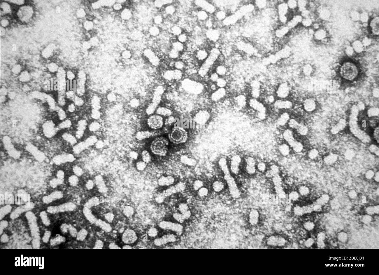 Ce micrographe électronique révèle la présence de VHB 'particules de dane' du virus de l'hépatite B, ou virions. Les virions infectieux de l'hépatite B (VHB) sont également appelés particules de Dane. Ces particules mesurent 42 nm dans leur diamètre global et contiennent un noyau à base d'ADN de 27 nm de diamètre. Banque D'Images