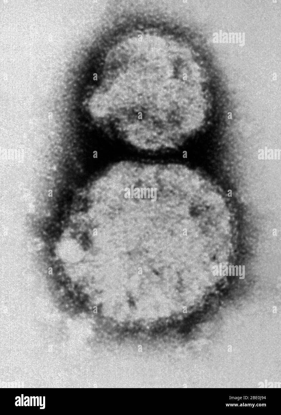 Le micrographe électronique à transmission colorée négative (TEM) décrit les virions du virus Sin Nombre (SNV), qui sont membres du genre Hantavirus, au sein de la famille des Bunyaviridae. Le virus Sin Nombre est la cause du syndrome cardioppulmonaire de l'hantavirus (HCP), également appelé syndrome pulmonaire de l'hantavirus (HPS), chez l'homme. En novembre 1993, le hantavirus spécifique à l'origine de l'éclosion des quatre coins a été isolé. Utilisant des tissus d'une souris de cerf qui avait été piégée près de la maison du Nouveau-Mexique d'une personne qui avait eu la maladie, la branche des agents pathogènes spéciaux de CDC a augmenté le virus en laboratoire Banque D'Images