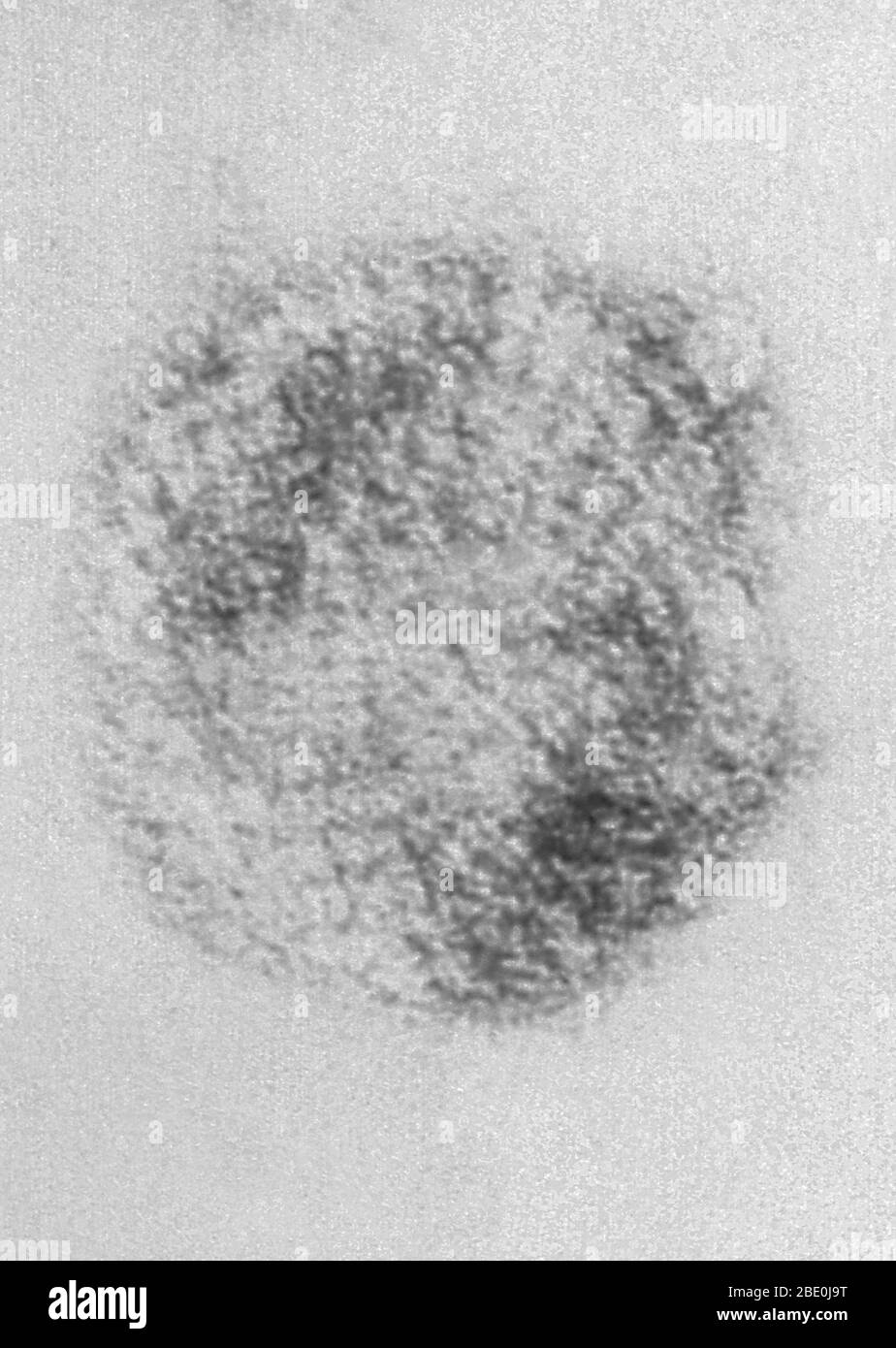 Le micrographe électronique à transmission colorée négative (TEM) décrit les virions du virus Sin Nombre (SNV), qui sont membres du genre Hantavirus, au sein de la famille des Bunyaviridae. Le virus Sin Nombre est la cause du syndrome cardioppulmonaire de l'hantavirus (HCP), également appelé syndrome pulmonaire de l'hantavirus (HPS), chez l'homme. En novembre 1993, le hantavirus spécifique à l'origine de l'éclosion des quatre coins a été isolé. Utilisant des tissus d'une souris de cerf qui avait été piégée près de la maison du Nouveau-Mexique d'une personne qui avait eu la maladie, la branche des agents pathogènes spéciaux de CDC a augmenté le virus en laboratoire Banque D'Images